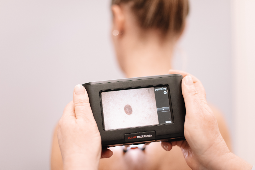 MoleMap Is Providing The Gold Standard For Melanoma Detection And ...